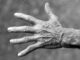 Hautalterung ist auch an den Händen sichtbar